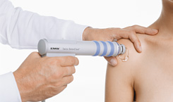 Example of Shockwave Therapy